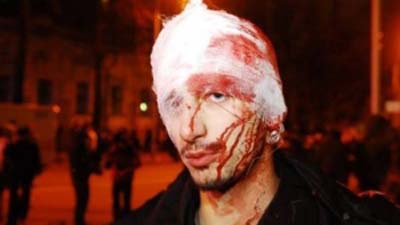 Избитый польский журналист хочет судиться с «Беркутом»