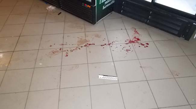 ​На Рівненщині поліцейські затримали молодика, який ножем тяжко поранив охоронця кафе