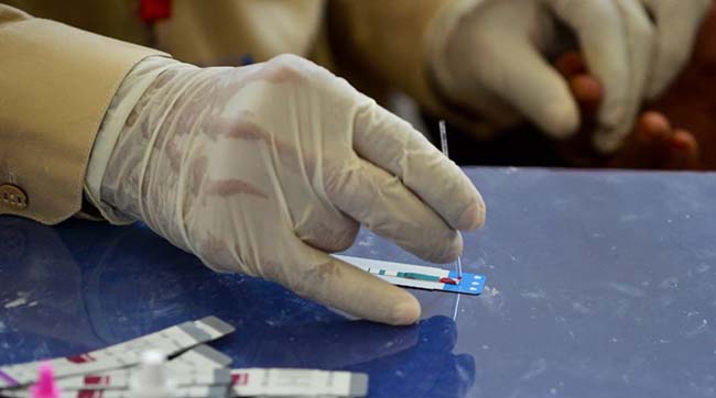 ​Боротьба з коронавірусом ускладнила доступ до лікування ВІЛ-інфікованим та хворим на СНІД