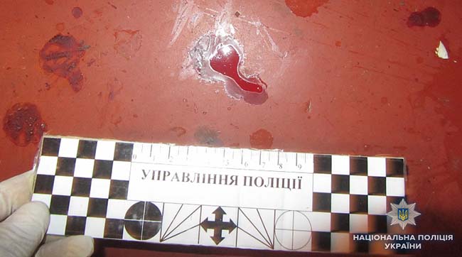 ​У Дарницькому районі поліція затримала жінку, яка ножем поранила співмешканця